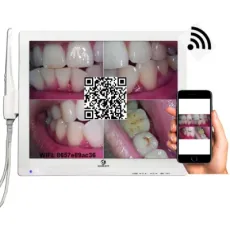 2MP High Pixel Digital Dental Intraoral Camera with 17 Inch Multimedia Monitor