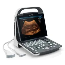 Mindray Dp-10 B/W Ultrasound Machine Digital Diagnostic Portable Prefessional Medical Equipment Ultrasound Scanner
