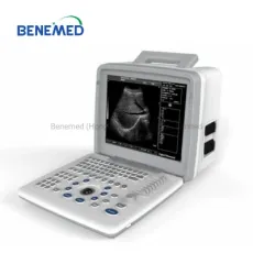 Portable B/W Ultrasound Scanner with Clear Image Quality